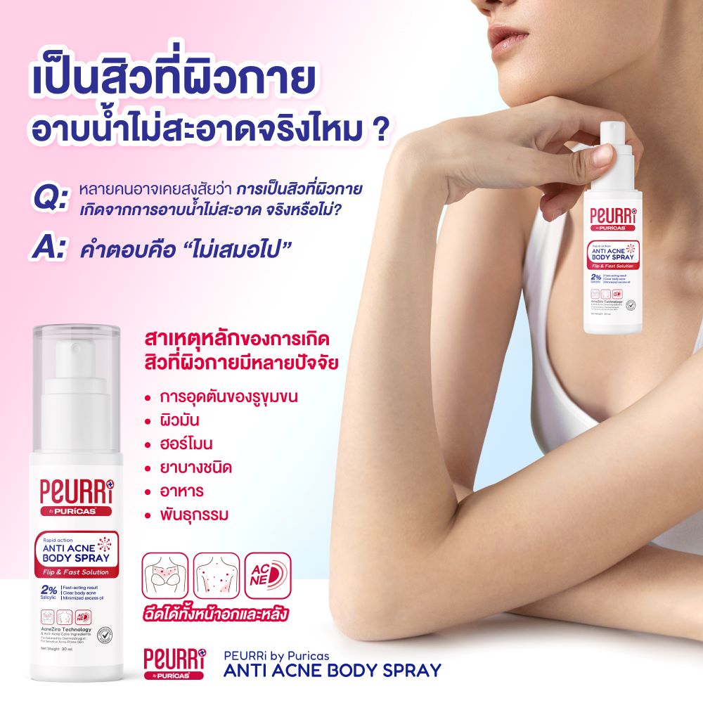 Peurri By Puricas Anti Acne Body Spray 30ml,Peurri Anti Acne Body Spray , Peurri  ราคา , Peurri  รีวิว , Peurri สิว , สิวที่หลัง